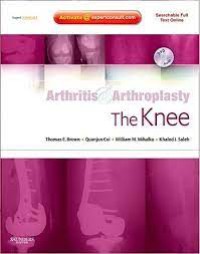 Arthritis & Arthoplasty the Knee