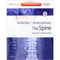 Arthritis & Arthroplasty The Spine