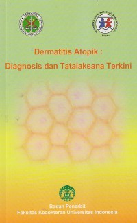 Dermatitis Atopik: Diagnosis dan Tatalaksana Terkini