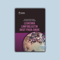 Leukemia, Limfoblastik Akut Pada Anak